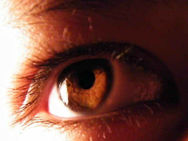 Facial Botox: Locations and Their Individual Effects