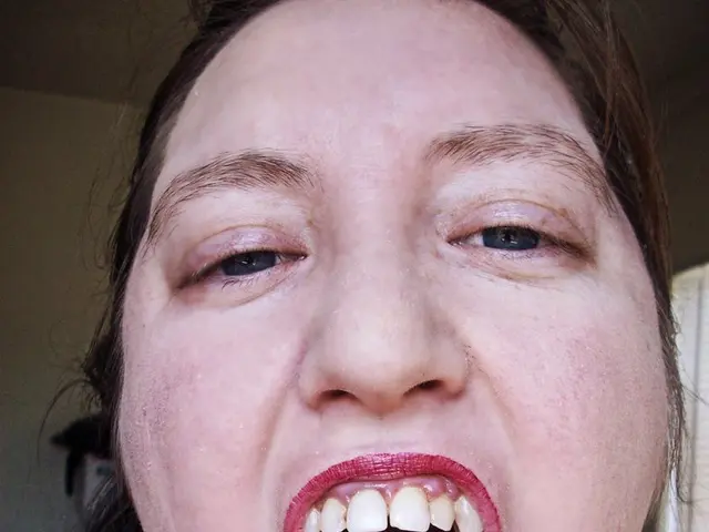 Known for her oversized lips, this woman has become a global phenomenon. A glimpse into her...