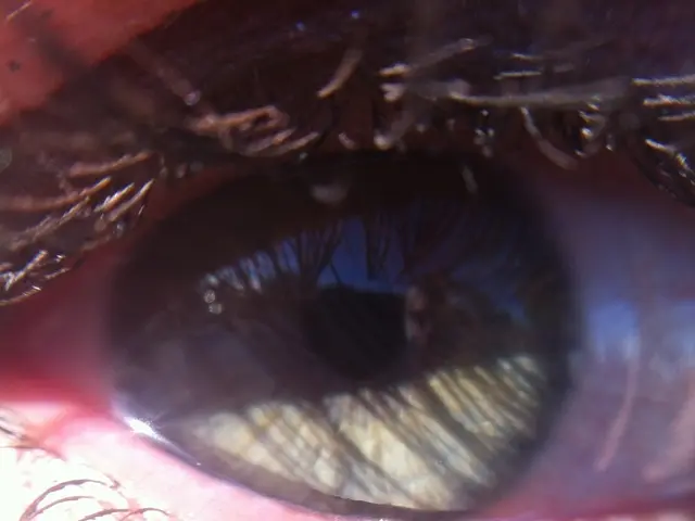 Method for Alleviating Puffy Eyes Due to Emotional Tears